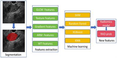 A machine learning model based on clinical features and ultrasound radiomics features for pancreatic tumor classification